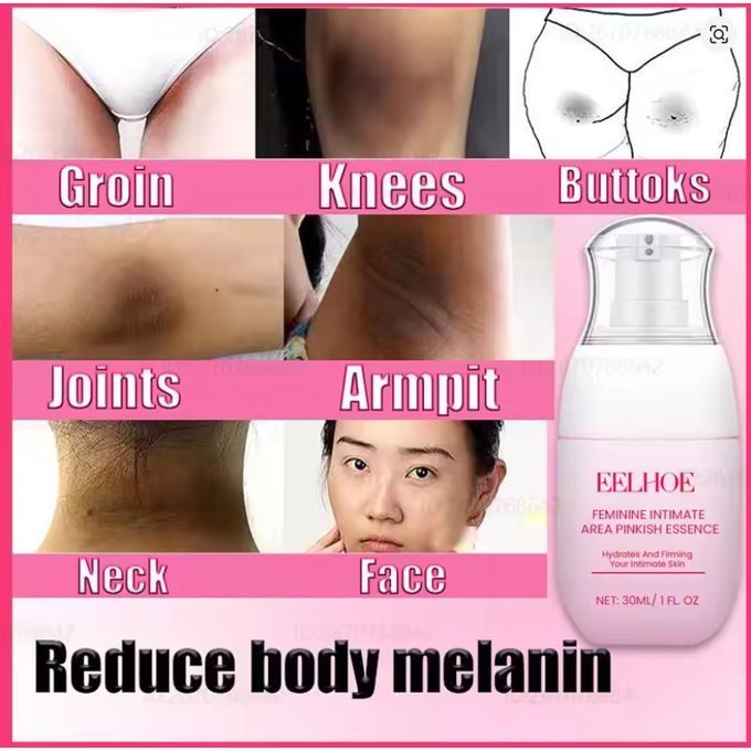 Sensitive parts whitening cream