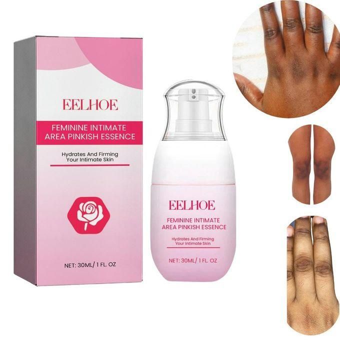 Sensitive parts whitening cream