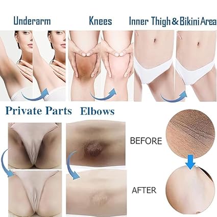 Lightening Cream Gel For Body Intimate Area