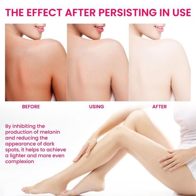Sensitive parts whitening cream