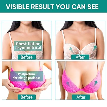 ITECFREELY Breast Enhancement Cream